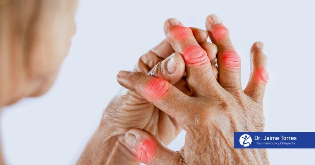 Consejos para mantener huesos y articulaciones sanos a edad avanzada