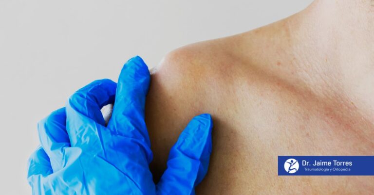 luxacion-de-clavicula