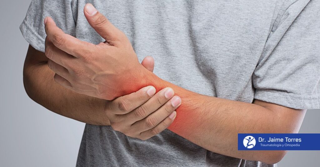 luxacion-muneca