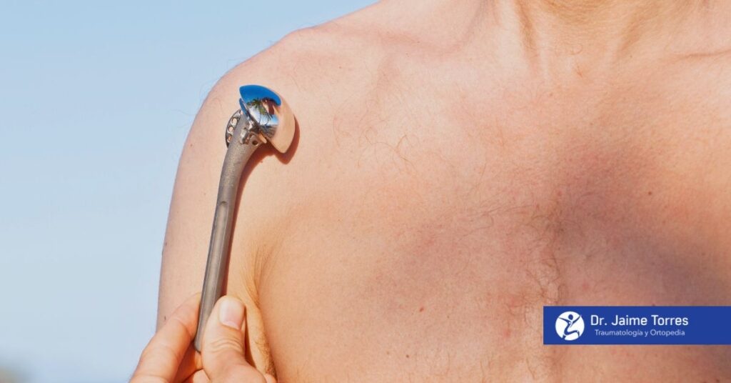 protesis-de-hombro