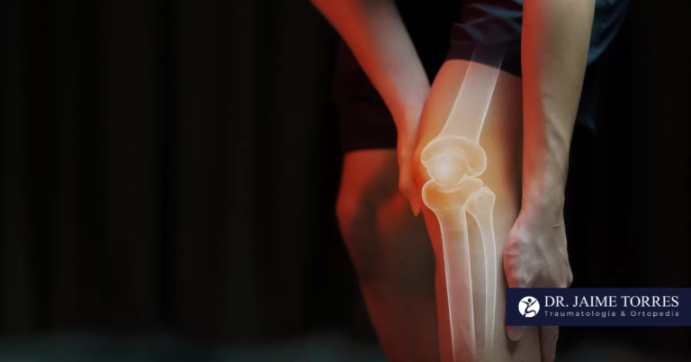 Dolor de rodilla en adultos jóvenes: causas frecuentes y soluciones médicas
