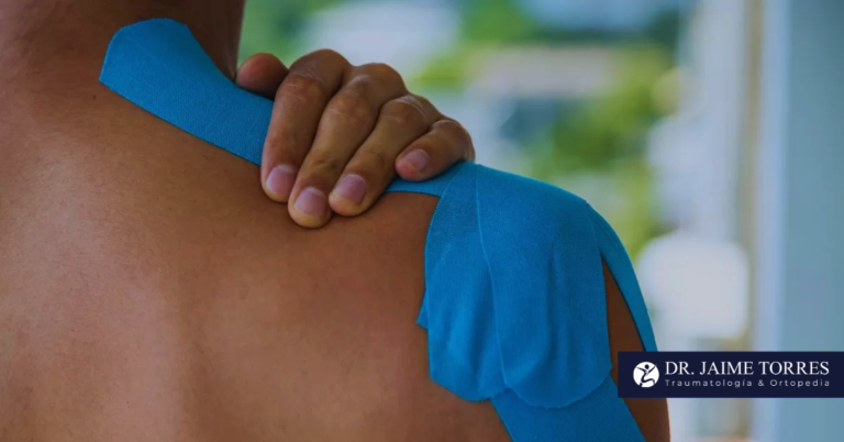 ¿Qué es y tiempos de recuperación de una luxación posterior de hombro?