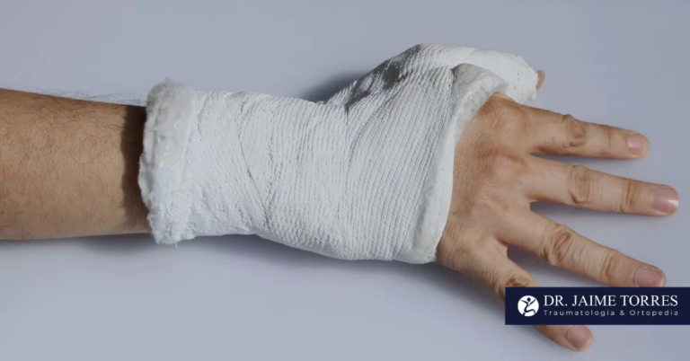 La fractura del boxeador, un problema común en traumatología y ortopedia que requiere atención especializada